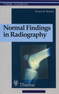Imagen de portada: Normal Findings in Radiography 1st edition 9783131165312