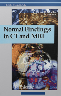 Cover image: Normal Findings in CT and MRI 1st edition 9783131165213
