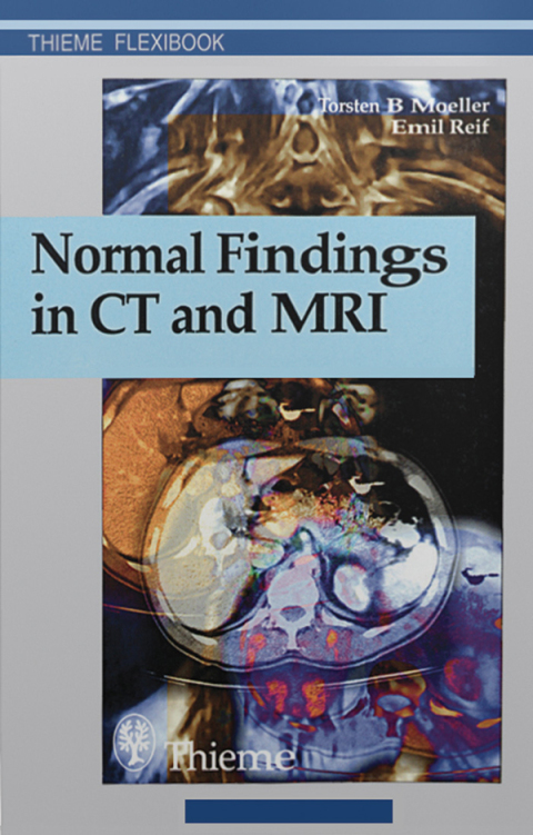 Normal Findings in CT and MRI, 1st Edition - FULL INSTANT DOWNLOAD | PDF DOCX EPUB