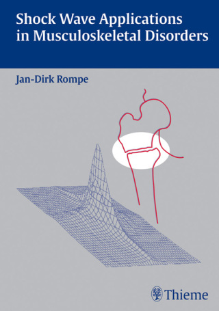 Cover image: Shock Wave Applications in Musculoskeletal Disorders 1st edition 9783131301215