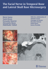 Cover image: The Facial Nerve in Temporal Bone and Lateral Skull Base Microsurgery 1st edition 9783131412812