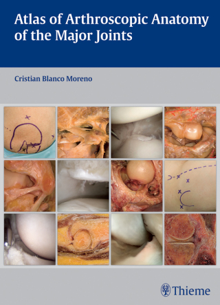Cover image: Atlas of Arthroscopic Anatomy of the Major Joints 1st edition 9783132037915