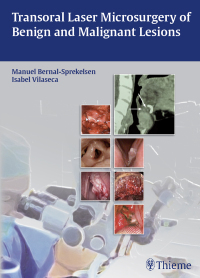 Cover image: Transoral Laser Microsurgery of Benign and Malignant Lesions 1st edition 9783131723918