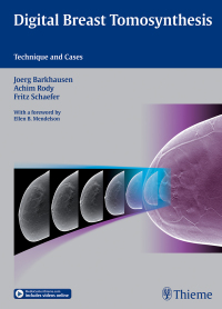 Cover image: Digital Breast Tomosynthesis 1st edition 9783132031616