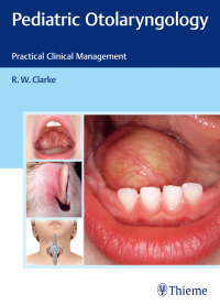 Titelbild: Pediatric Otolaryngology 1st edition 9783131699015