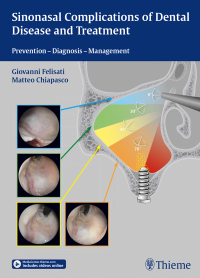 Cover image: Sinonasal Complications of Dental Disease and Treatment 1st edition 9783131997012