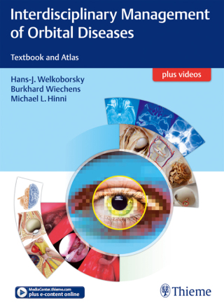 Omslagafbeelding: Interdisciplinary Management of Orbital Diseases 1st edition 9783131994219