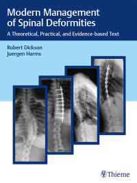 صورة الغلاف: Modern Management of Spinal Deformities 1st edition 9783132431867