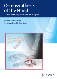 Cover image: Osteosynthesis of the Hand 1st edition 9783132038110