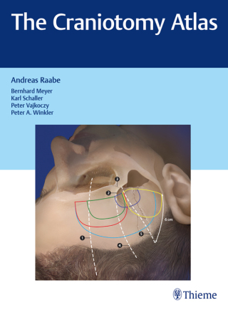 Cover image: The Craniotomy Atlas 1st edition 9783132057913