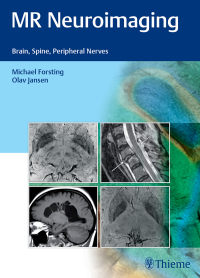 Cover image: MR Neuroimaging 1st edition 9783132026810