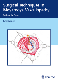 Cover image: Surgical Techniques in Moyamoya Vasculopathy 1st edition 9783131450616