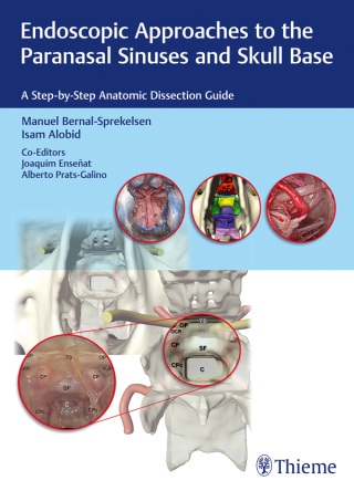 Cover image: Endoscopic Approaches to the Paranasal Sinuses and Skull Base 1st edition 9783132018815