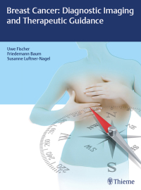 Cover image: Breast Cancer: Diagnostic Imaging and Therapeutic Guidance 1st edition 9783132019317