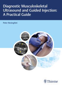 Omslagafbeelding: Diagnostic Musculoskeletal Ultrasound and Guided Injection: A Practical Guide 1st edition 9783132203815