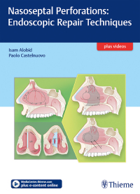 表紙画像: Nasoseptal Perforations: Endoscopic Repair Techniques 1st edition 9783132053915