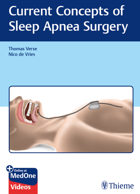 Current Concepts of Sleep Apnea Surgery, 1st Edition - FULL INSTANT DOWNLOAD | PDF DOCX EPUB