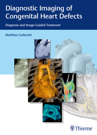 Cover image: Diagnostic Imaging of Congenital Heart Defects 1st edition 9783132402515