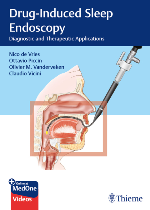 Drug-Induced Sleep Endoscopy: Diagnostic and Therapeutic Applications, 1st Edition - FULL INSTANT DOWNLOAD | PDF DOCX EPUB