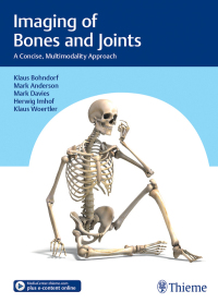 صورة الغلاف: Imaging of Bones and Joints 1st edition 9783132406476