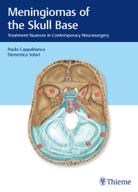 صورة الغلاف: Meningiomas of the Skull Base 1st edition 9783132412866