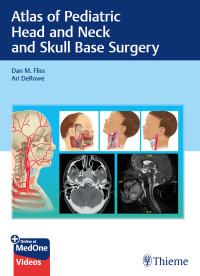 Cover image: Atlas of Pediatric Head and Neck and Skull Base Surgery 1st edition 9783132414273