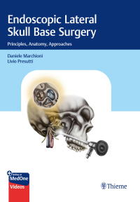 Titelbild: Endoscopic Lateral Skull Base Surgery 1st edition 9783132412774