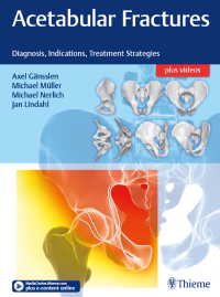 Cover image: Acetabular Fractures 1st edition 9783132415607