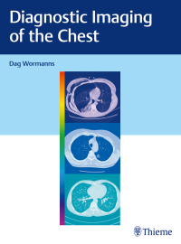 Imagen de portada: Diagnostic Imaging of the Chest 1st edition 9783132415669