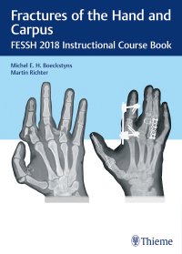 Cover image: Fractures of the Hand and Carpus 1st edition 9783132417205