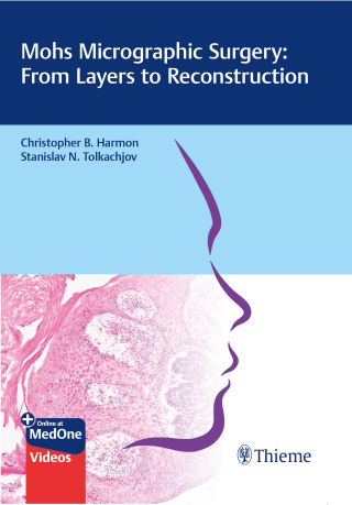 Cover image: Mohs Micrographic Surgery: From Layers to Reconstruction 1st edition 9783132420175