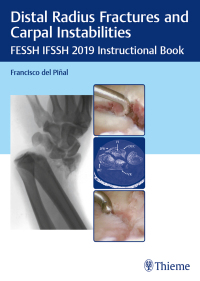 Cover image: Distal Radius Fractures and Carpal Instabilities 1st edition 9783132423794