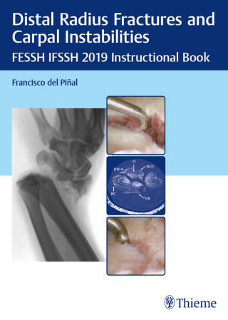 Titelbild: Distal Radius Fractures and Carpal Instabilities 1st edition 9783132423794