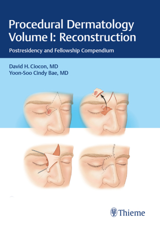 Cover image: Procedural Dermatology Volume I: Reconstruction 1st edition 9783132424050