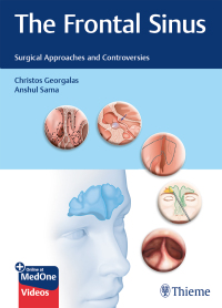 Cover image: The Frontal Sinus 1st edition 9783132400528