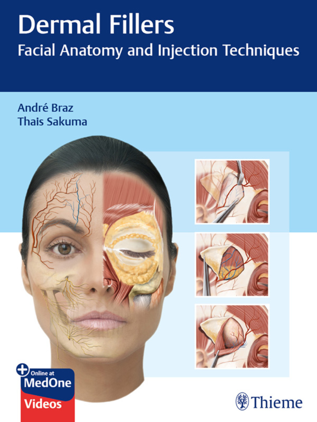 Dermal Fillers Facial Anatomy and Injection Techniques 1st Edition