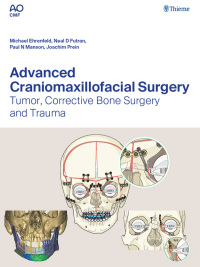صورة الغلاف: Advanced Craniomaxillofacial Surgery 1st edition 9783132428393