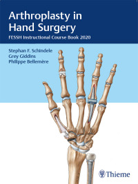 Cover image: Arthroplasty in Hand Surgery 1st edition 9783132431744