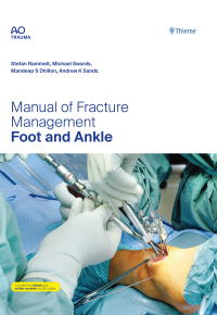 Cover image: Manual of Fracture Management - Foot and Ankle 1st edition 9783132434585