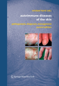 Titelbild: Autoimmune Diseases of the Skin 2nd edition 9783211206867