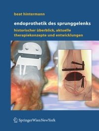 Cover image: Endoprothetik des Sprunggelenks 9783211235867
