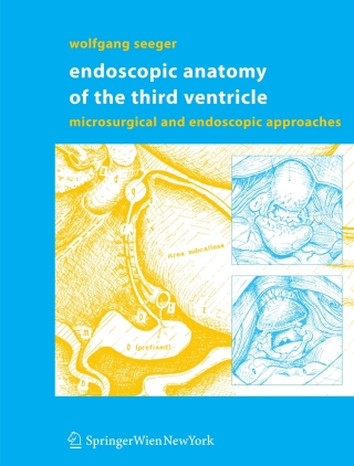 Imagen de portada: Endoscopic Anatomy of the Third Ventricle 9783211311776