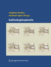 Cover image: Ballonkyphoplastie 1st edition 9783211235928