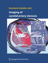 Titelbild: Imaging of Carotid Artery Stenosis 1st edition 9783211323328