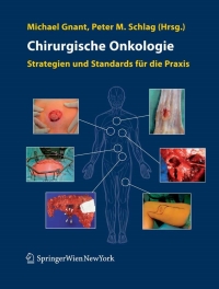 Cover image: Chirurgische Onkologie 1st edition 9783211486122