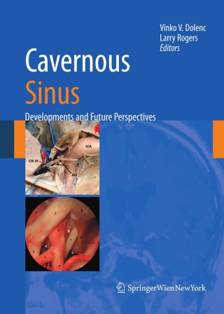 Imagen de portada: Cavernous Sinus 1st edition 9783211721377