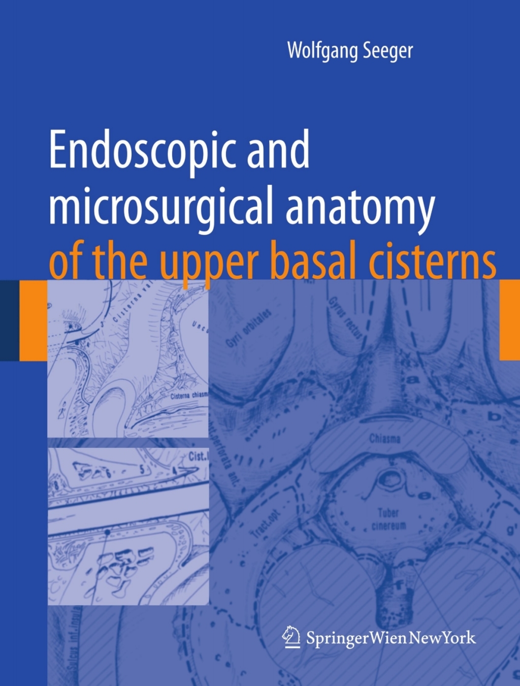 Endoscopic and microsurgical anatomy of the upper basal cisterns
