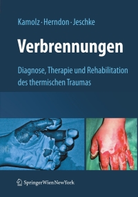 Cover image: Verbrennungen 1st edition 9783211798959