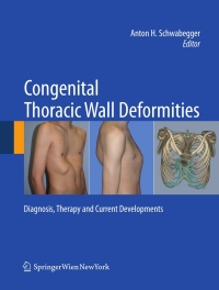 صورة الغلاف: Congenital Thoracic Wall Deformities 1st edition 9783211991374
