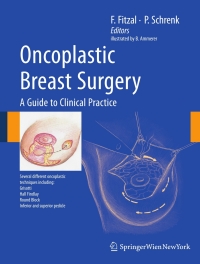 Titelbild: Oncoplastic Breast Surgery 1st edition 9783211993163